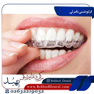ارتودنسی-نامرئی