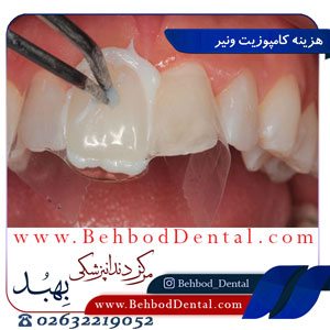 هزینه-کامپوزیت-ونیر